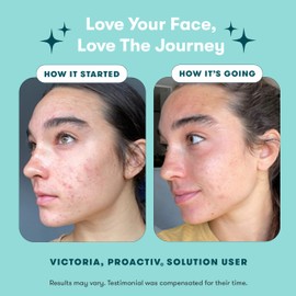 Proactiv 3 Step Acne Treatment - Benzoyl Peroxide Face Wash, Repairing Acne Spot Treatment for Face and Body, Exfoliating Toner - 30 Day Complete Acne Skin Care Kit