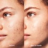 CLEANSER BB ACNE CLARIFYING