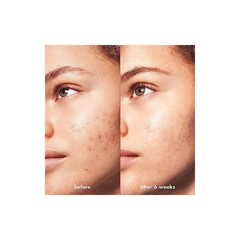 CLEANSER BB ACNE CLARIFYING