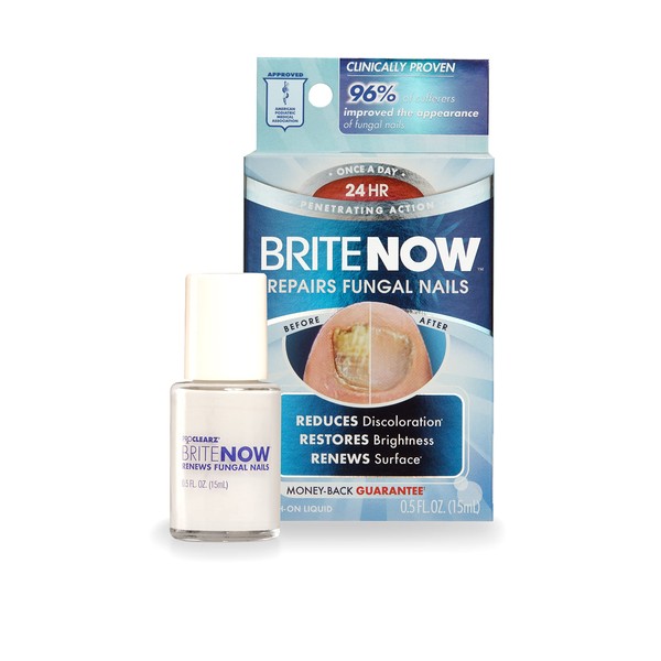 ProClearz Brite Now Nail Treatment, Restores The Appearance Of Damaged & Discolored Nails, Peel-Away Technology, Brightening & Smoothing Nail Repair, 0.5 Ounce
