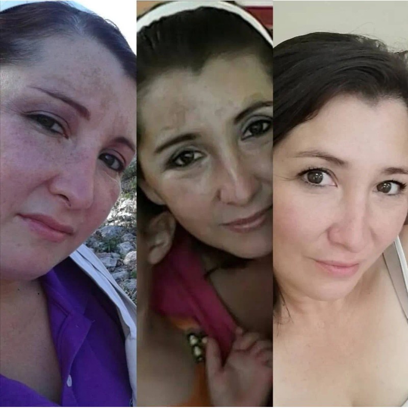 Crema Concha Nacar Para Manchas O Paño Despigmentante 250 Ml