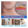 Crema Para Lipomas Y Bultos Grasos South Moon 20g Ginger