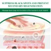 2×tratamento Manchas Escuras Tratamento Hiperpigmentação /