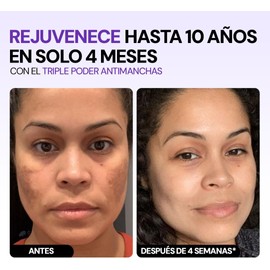Kit Glow Intensivo 3 Pasos – Mesowhite + Serum 21 Days + Crema para Ojos Luminosidad, Hidratación y Cuidado Antiedad