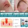 KOAHDE Tragbarer Flüssiger Verband Für Die Haut,Gel Verbandpflaster,Wundpflege Gel Flüssigkeit,Wasserfester