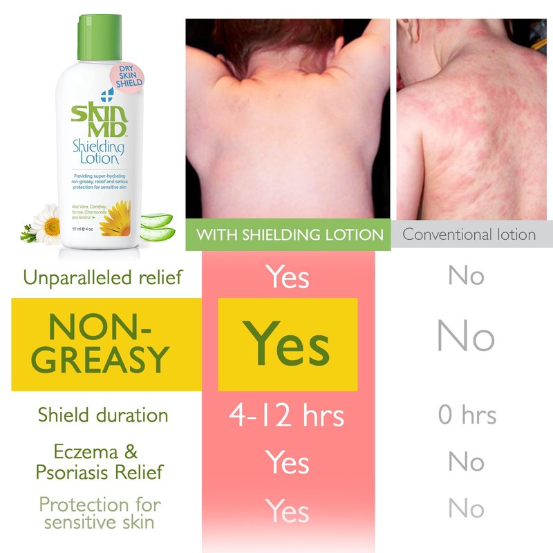Skin MD Shielding Lotion - 4oz Hydrating Body Lotion for