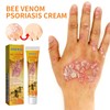 Wellness South Moon Anti-Itch Bee Venom Psoriasis Cream Cooling Soothing