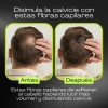 Fibras Capilares Naturales 25g Disimular Calvicie Cabello F