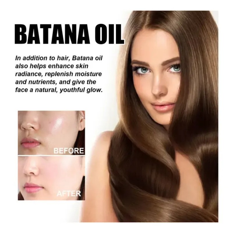 Aceite De Batana De 60ml*3 Para El Crecimiento Del Cabello