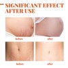 INTIMIFY Stretch Mark Removal Cream For Women, Stretch Mark Cream