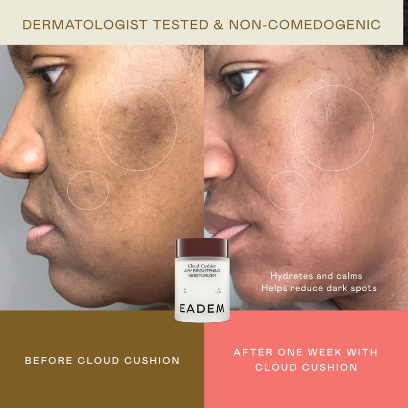 EADEM Cloud Cushion, Face Moisturizer Cream, Skin Care Ultra Repair