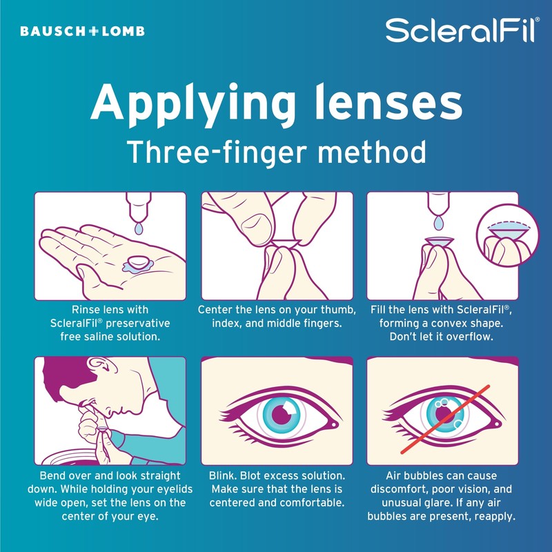 Branded ScleralFil Preservative Free Saline Solution for Scleral, Soft, &