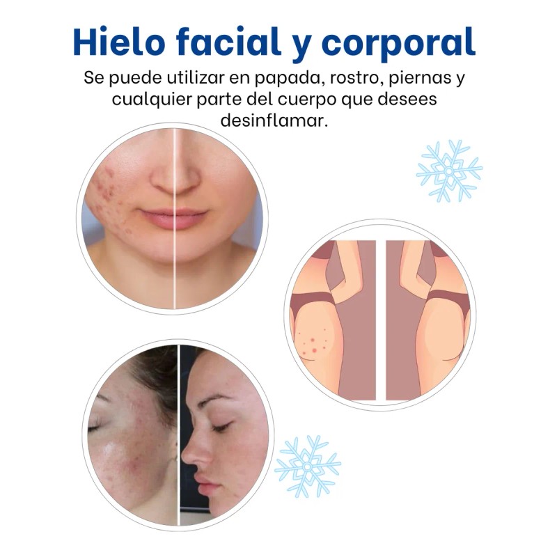 Kit Hielos Faciales Antiacné Anti-imperfeccion Hieloterapia