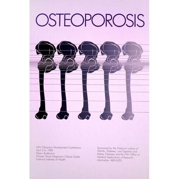 Osteoporosis (1984) Poster Print by National Institutes of Health (24