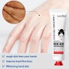 Crema Ácida Antiarrugas Kojic Nourish Suave Skin