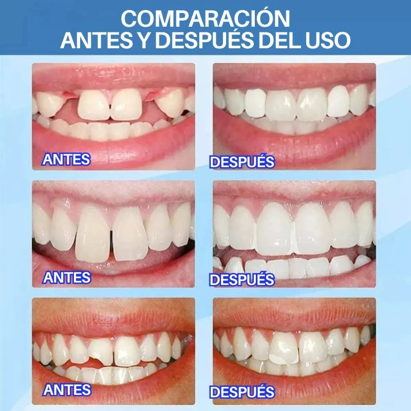 Perlas Reparación Dientes 30ml Granulos Postizos