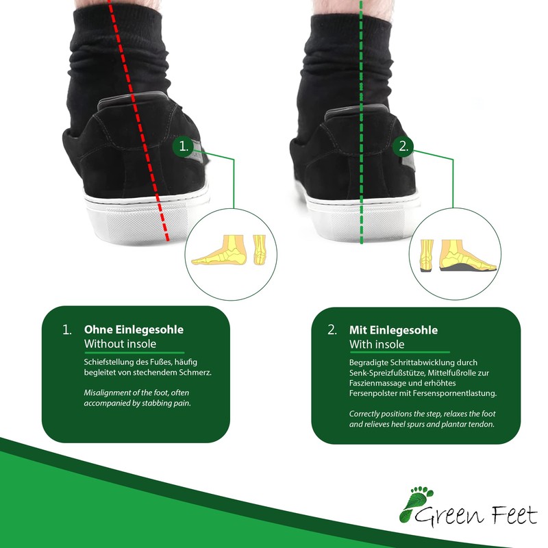 Green-Feet Orthopaedic Insoles Further Designed For Lower Arch Foot Splayfoot