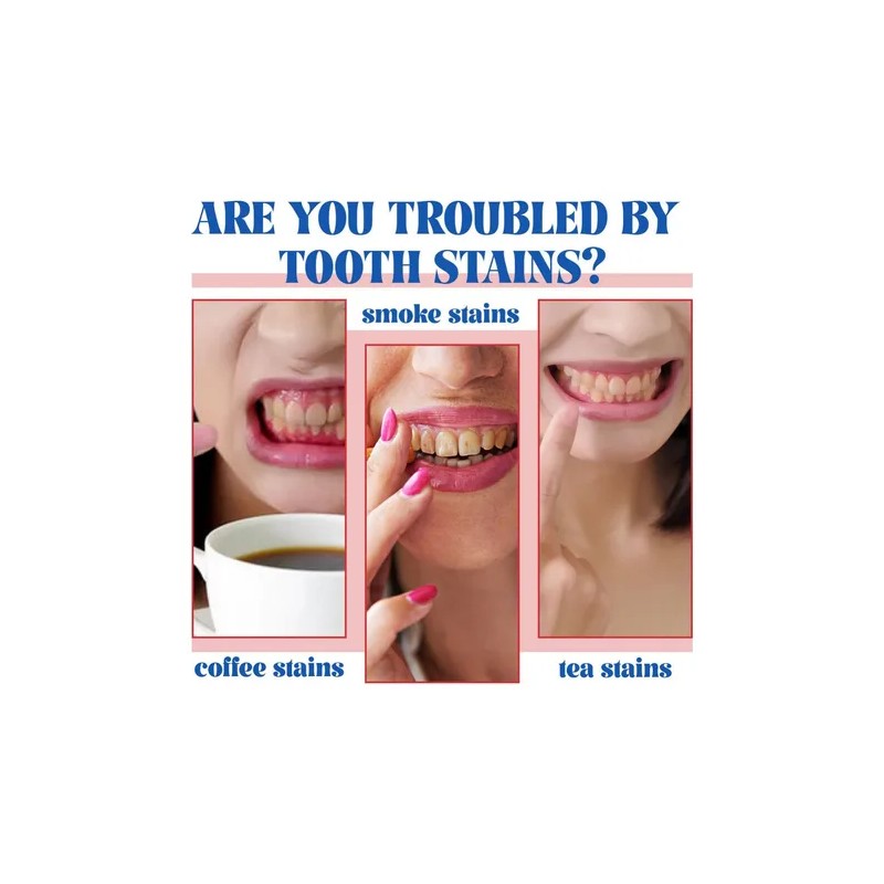 Sp-6 Whitening Probiotics Toothpaste Toothbrushes, 3pcs