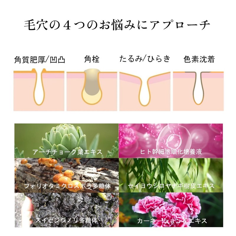 ヒト幹細胞 化粧水 ワビオ ステム アクティブ ローション 新バージョン 毛穴対策 高保湿 低刺激処方