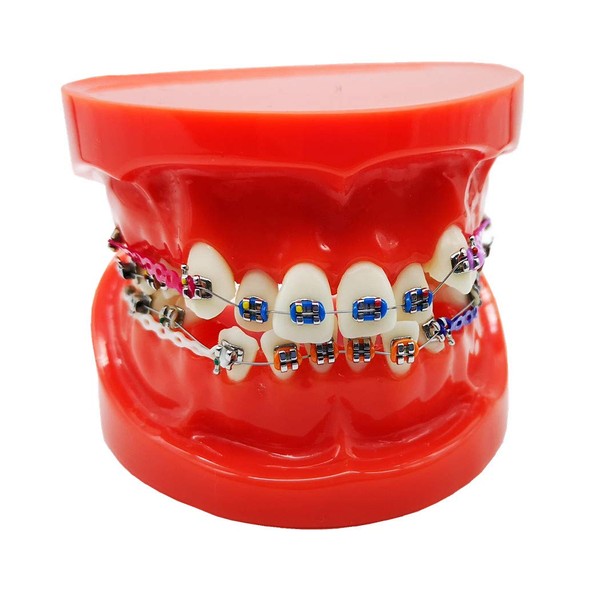Dental Typodont With Metal Brackets Orthodontic Teeth Model With Ligature