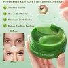 Under Eye Patches for Dark Circles, Puffiness and Eye Bags,