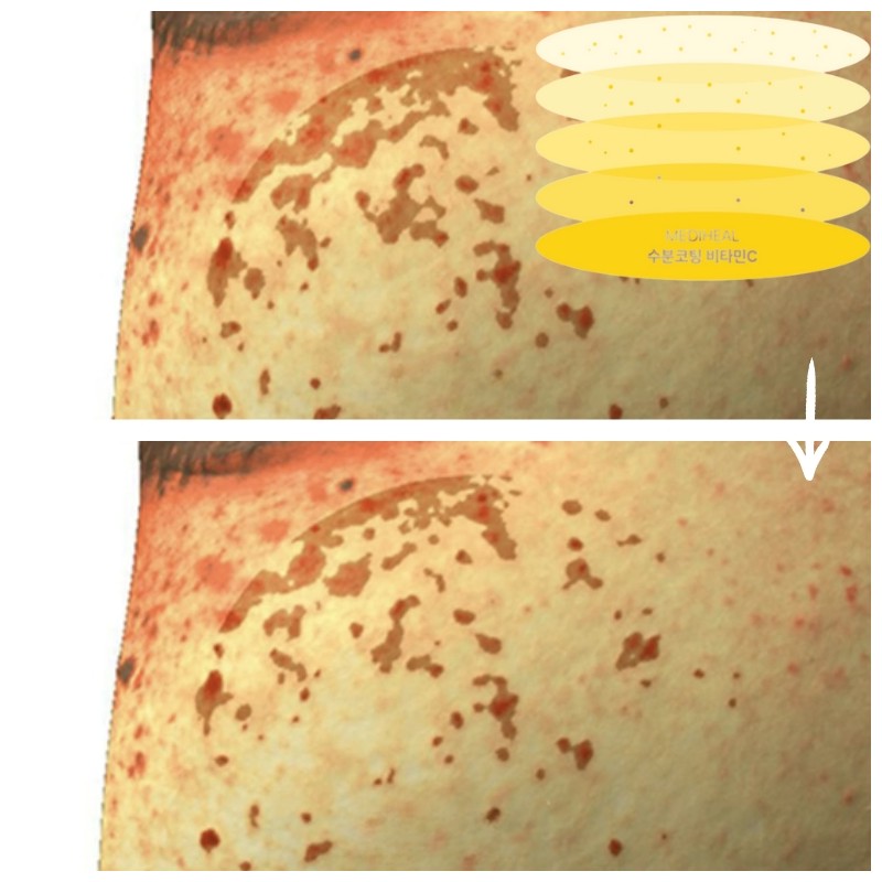 MEDIHEAL Essential Mask 24ml*10ea, Type:Madecassoside