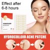 Unbranded 144 PCS Hydrocolloid Pimple Patches for Face - Acne