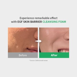 zipiderm [zipiderm]EGF Skin Barrier Cleansing Foam 120ml