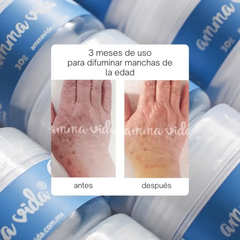 Crema Anti Manchas Amma Vida