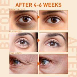 Under Eye Serum For Puffiness: Caffeine Under Eye Treatment Reducing Eye Bags and Dark Circles In 2 Week - Eye Wrinkles & Fine Lines Smoothing Cream for Late Nights, Overtime and Makeup Prep