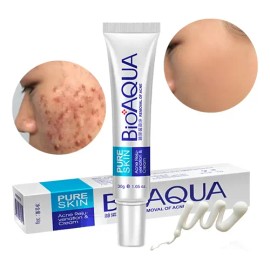 Cuidado Facial Crema Eliminación De Acné Senana Marina 1pz                                                                                            