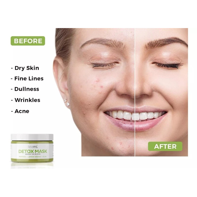 Teami Mascarillas Desintoxicantes Para El Cuidado De La Piel
