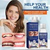 30ML Temporary Tooth Filling,Moldable False Teeth for Fixing,Temporary Tooth Repair