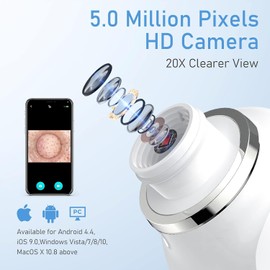 Blackhead Remover Vacuum, USB Interface Type Pore Vacuum, Black Head Extractions Tool with Camerafor, Men and Women Pore Cleaner, 3 Adjustment Modes & 6 Suction Heads(Light Pink)