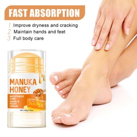 60% Urea Cream - 1.41 oz Manuka Honey Foot Hand Cream Stick for Dry & Cracked Feet Elbows Knees Heels Hands, Hydrates & Nourish Foot Care for Softening and Moisturizing, Removing Calloused Skin