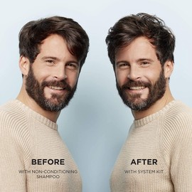 Nioxin Cleanser & Scalp Therapy System 1 Shampoo & Conditioner Duo / Twin Pack 300 ml