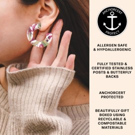 Pink and Green Tortoise Shell Hypoallergenic Chunky Hoop Earrings | Allergen Safe Earrings, Bold Bright Colourful Statement Hoop, Lightweight, Acetate, Acrylic, Resin, Gift for Her