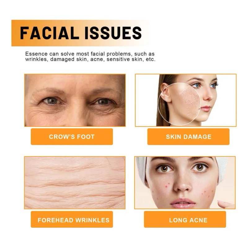 Un Tratamiento Facial Vitamínico Desaliniza Las Líneas Finas