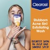 Clearasil Clearasil ultra - 5in1 exfoliating wash, 6.78 Ounce
