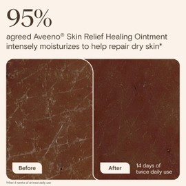Aveeno Skin Relief Healing Ointment, Glycerin Skin Protectant with Triple Oat & Shea Butter to Repair & Protect Extra Dry, Cracked & Sensitive Skin, Fragrance-Free & Non-Greasy, 7.2 oz