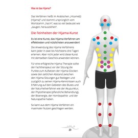 Hijama Hacamat Cupping (Schöpftherapie) German