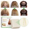 Rice Water for Hair Shampoo Bar Solid Shampoo Against Hair