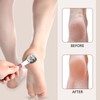 Stainless Steel Callus Slicer Foot Including 10 Replacement Blades -