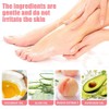 Anti-Cracking Cream, For Dry Cracked Feet And Hands, Prevent From