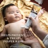 A+D Original Diaper Rash Ointment, Skin Protectant With Lanolin and