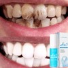 HA5 Brightening Toothpaste, 360° Tooth Protection, 30 ml