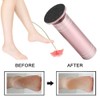 Automatic Electric Foot Grinding Machine Exfoliating Dead Skin Callus Removal