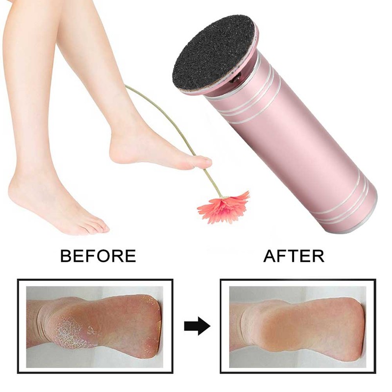 Automatic Electric Foot Grinding Machine Exfoliating Dead Skin Callus Removal