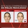 L'Oréal Paris Revitalift Laser Crema de Día Antiedad Triple Acción,