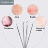 DHWEKU 4 Pieces Blackhead Remover Comedone Squeezer Kit, Blackhead Remover